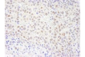 Immunohistochemistry (IHC) image for anti-Replication Protein A1, 70kDa (RPA1) (AA 350-400) antibody (ABIN7448781)