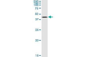 ACAT2 MaxPab rabbit polyclonal antibody. (ACAT2 抗体  (AA 1-397))