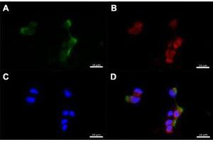 Immunofluorescent staining of human nasal epithelial cells with CD151 polyclonal antibody  at 1:100 dilution.