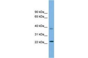 Image no. 1 for anti-Transcription Factor Dp Family, Member 3 (TFDP3) (AA 71-120) antibody (ABIN6745240) (TFDP3 抗体  (AA 71-120))