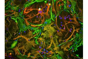 View of mixed neuron/glial cultures stained with vimentin antibody (green) and rabbit antibody to GFAP antibody (red). (Vimentin 抗体)