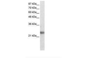 Image no. 1 for anti-Ring Finger Protein 114 (RNF114) (AA 77-126) antibody (ABIN202094) (RNF114 抗体  (AA 77-126))