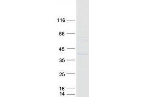 Validation with Western Blot