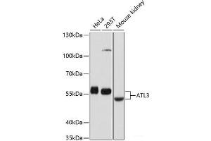 Western blot analysis of extracts of various cell lines using ATL3 Polyclonal Antibody at dilution of 1:1000. (ATL3 抗体)