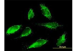 Immunofluorescence of purified MaxPab antibody to SCO1 on HepG2 cell. (SCO1 抗体  (AA 1-301))