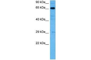 Western Blotting (WB) image for anti-Solute Carrier Family 6 (Neurotransmitter Transporter, Noradrenalin), Member 2 (SLC6A2) (Middle Region) antibody (ABIN2777051)
