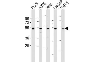 All lanes : Anti-NFKBIE Antibody (N-term) at 1:2000 dilution Lane 1: PC-3 whole cell lysates Lane 2:  whole cell lysates Lane 3: Hela whole cell lysates Lane 4: LNCaP whole cell lysates Lane 5: THP-1 whole cell lysates Lysates/proteins at 20 μg per lane. (NFKBIE 抗体  (N-Term))
