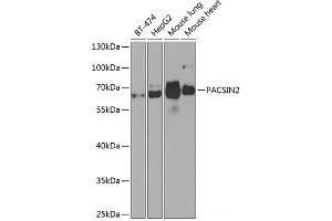 Western blot analysis of extracts of various cell lines using PACSIN2 Polyclonal Antibody at dilution of 1:1000. (PACSIN2 抗体)