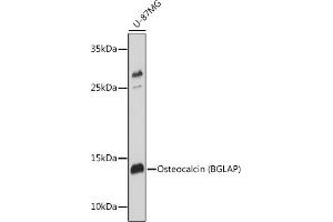 Western blot analysis of extracts of U-87MG cells, using Osteocalcin (BGLAP) antibody (ABIN6134565, ABIN6137546, ABIN6137547 and ABIN6221793) at 1:1000 dilution. (Osteocalcin 抗体  (AA 1-100))
