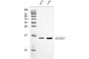 Western blot analysis of CRABP2 using anti-CRABP2 antibody (ABIN7602146).