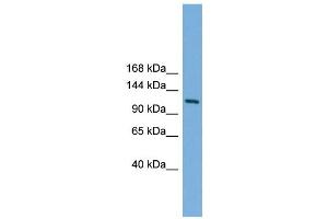 WB Suggested Anti-Myt1 Antibody Titration: 0. (MYT1 抗体  (N-Term))