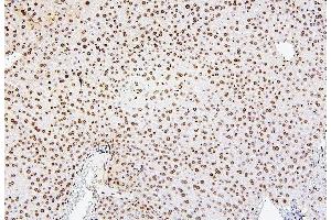 IHC analysis of H1F0 using anti-H1F0 antibody (ABIN7600521).