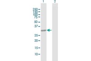 Western Blot analysis of CBR1 expression in transfected 293T cell line by CBR1 MaxPab polyclonal antibody. (CBR1 抗体  (AA 1-277))
