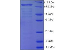 SDS-PAGE (SDS) image for F-Box Protein 11 (FBXO11) (AA 24-633) protein (His tag) (ABIN5710712)