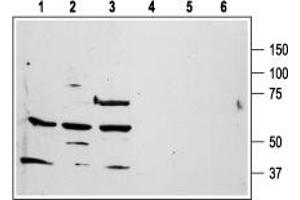 Western Blotting (WB) image for anti-Coagulation Factor II (thrombin) Receptor (F2R) (AA 61-76), (Extracellular) antibody (ABIN7043073)