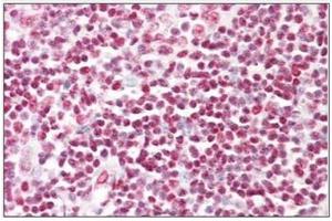 Human Tonsil: Formalin-Fixed, Paraffin-Embedded (FFPE) (HNRNPD/AUF1 抗体)