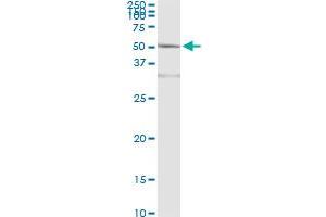 Immunoprecipitation of ACY1 transfected lysate using anti-ACY1 monoclonal antibody and Protein A Magnetic Bead , and immunoblotted with ACY1 MaxPab rabbit polyclonal antibody. (Aminoacylase 1 抗体  (AA 1-408))