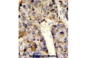 Immunohistochemistry (IHC) image for anti-Heterogeneous Nuclear Ribonucleoprotein L (HNRNPL) antibody (ABIN3001739) (HNRNPL 抗体)