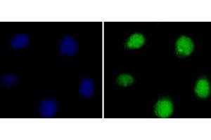 Immunofluorescence analysis of 293T cells using Symmetric DiMethyl-Histone H3-R8 Polyclonal Antibody (Histone 3 抗体  (H3R8me2s))