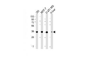 All lanes : Anti-PDXK Antibody (N-term) at 1:4000 dilution Lane 1: 293 whole cell lysate Lane 2: MCF-7 whole cell lysate Lane 3: U-251 MG whole cell lysate Lane 4: Human liver lysate Lysates/proteins at 20 μg per lane. (PDXK 抗体  (AA 1-312))