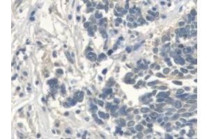 Immunohistochemistry (IHC) image for anti-UDP-Glucose Ceramide Glucosyltransferase (UGCG) (AA 39-171) antibody (ABIN7443101)