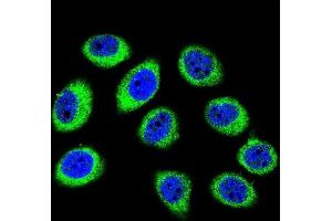 Confocal immunofluorescent analysis of GCLC Antibody (N-term) (ABIN655884 and ABIN2845285) with U-251MG cell followed by Alexa Fluor 488-conjugated goat anti-rabbit lgG (green). (GCLC 抗体  (N-Term))