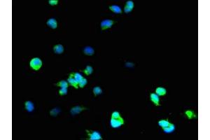 Immunofluorescent analysis of 293T cells using ABIN7170979 at dilution of 1:100 and Alexa Fluor 488-congugated AffiniPure Goat Anti-Rabbit IgG(H+L) (SOD1 抗体  (AA 2-154))