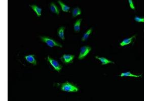 Immunofluorescent analysis of Hela cells using ABIN7170906 at dilution of 1:100 and Alexa Fluor 488-congugated AffiniPure Goat Anti-Rabbit IgG(H+L) (SUCNR1 抗体  (AA 303-334))