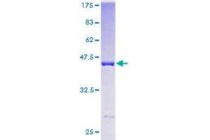 CPI-17 Protein (AA 1-147) (GST tag)