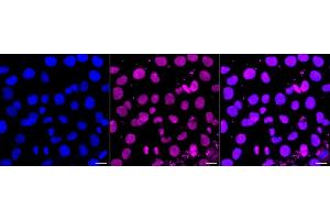 Immunocytochemical staining of HT- cells with SENP2 antibody (ABIN7800976), 1:1,000). (Recombinant SUMO Specific Peptidase 2 抗体)