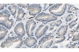ABIN6269323 at 1/100 staining Human prostate tissue by IHC-P. (LIPE 抗体  (Internal Region))