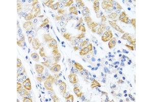 Immunohistochemistry of paraffin-embedded Human stomach using CDKN2C Polyclonal Antibody at dilution of 1:100 (40x lens). (CDKN2C 抗体)