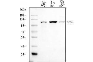 Western blot analysis of ERN2 using anti-ERN2 antibody (ABIN7601945).