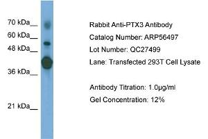 WB Suggested Anti-PTX3  Antibody Titration: 0. (PTX3 抗体  (N-Term))