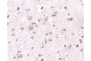 Immunohistochemistry of BRE in human brain tissue with BRE polyclonal antibody  at 2. (BRE 抗体  (N-Term))