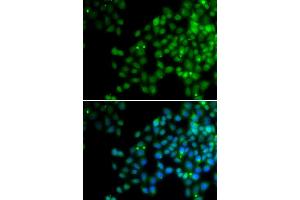 Immunofluorescence analysis of HeLa cells using EPC1 antibody. (EPC1 抗体)