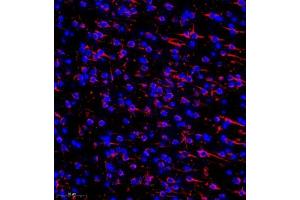Immunofluorescence of paraffin embedded mouse brain using MAP9 (ABIN7074622) at dilution of 1:750 (300x lens) (MAP9 抗体)