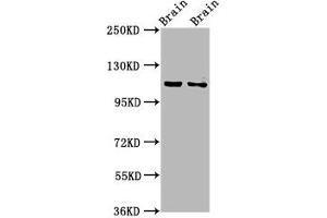 Western Blot Positive WB detected in: Rat brain tissue, Mouse brain tissue All lanes: CLIP2 antibody at 3. (CLIP2 抗体  (AA 101-217))