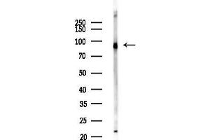 anti-Aldehyde Dehydrogenase 1 Family, Member L1 (ALDH1L1) (C-Term) antibody