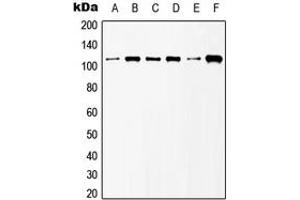 Western blot analysis of mGLUR6 expression in HeLa (A), NIH3T3 (B), Raw264. (Metabotropic Glutamate Receptor 6 抗体  (C-Term))