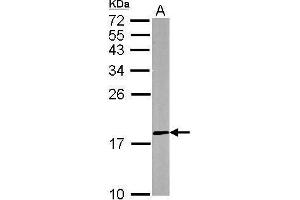 WB Image Sample (50 ug of whole cell lysate) A: mouse brain 12% SDS PAGE antibody diluted at 1:500 (DUSP26 抗体  (Center))
