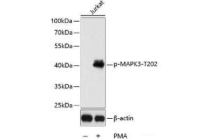 Western blot analysis of extracts of Jurkat cells using Phospho-MAPK3(T202) Polyclonal Antibody at dilution of 1:2000. (ERK1 抗体  (pThr202))