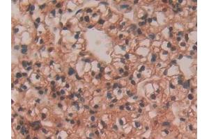Immunohistochemistry (IHC) image for anti-Vav 3 Oncogene (VAV3) (AA 183-380) antibody (ABIN7437782)