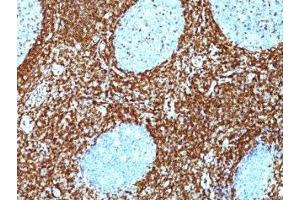 Immunohistochemistry (IHC) image for anti-B-Cell CLL/lymphoma 2 (BCL2) antibody (ABIN3026601)