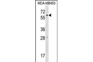 RPUSD2 Antibody (N-term) (ABIN1539609 and ABIN2848866) western blot analysis in MDA-M cell line lysates (35 μg/lane). (RPUSD2 抗体  (N-Term))