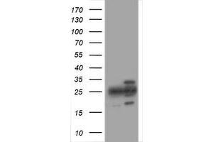 Image no. 1 for anti-Proteasome Subunit alpha 2 (PSMA2) (AA 50-234) antibody (ABIN1491571) (PSMA2 抗体  (AA 50-234))