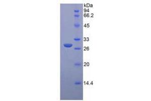 SDS-PAGE analysis of Rat Glucuronidase beta Protein. (Glucuronidase beta 蛋白)