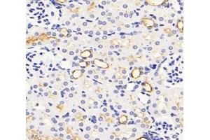 Immunohistochemistry analysis of paraffin-embedded mouse kidney using,NHE-3 (ABIN7075685) at dilution of 1: 1200 (SLC9A3 抗体)