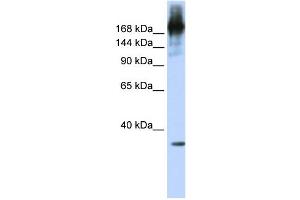 WB Suggested Anti-PRPF8 Antibody Titration:  0. (PRPF8 抗体  (N-Term))