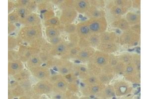 Detection of C2 in Human Liver Tissue using Polyclonal Antibody to Complement Component 2 (C2) (Complement C2 抗体  (AA 245-451))